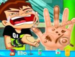 Ben10 Hand Doctor – Joc online gratuit